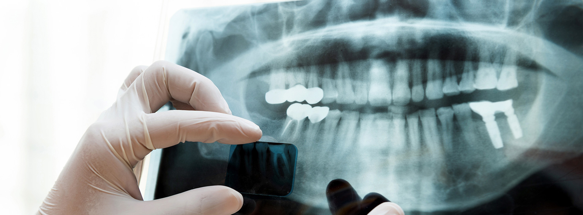 New Image Dentistry | Dental Cleanings, Sports Mouthguards and All-on-4 reg